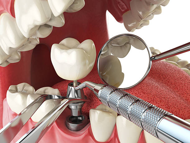 Best Emergency Dental Surgery in Corning, CA